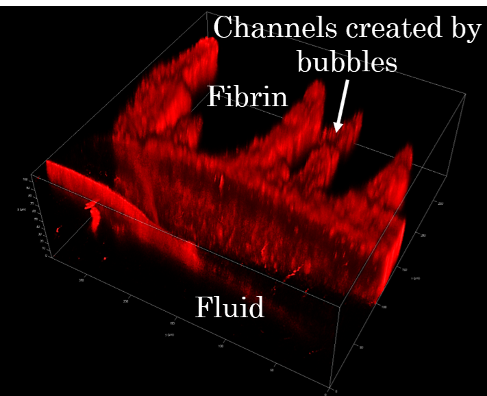 Microchannels formed through a fibrin network by oscillating bubbles