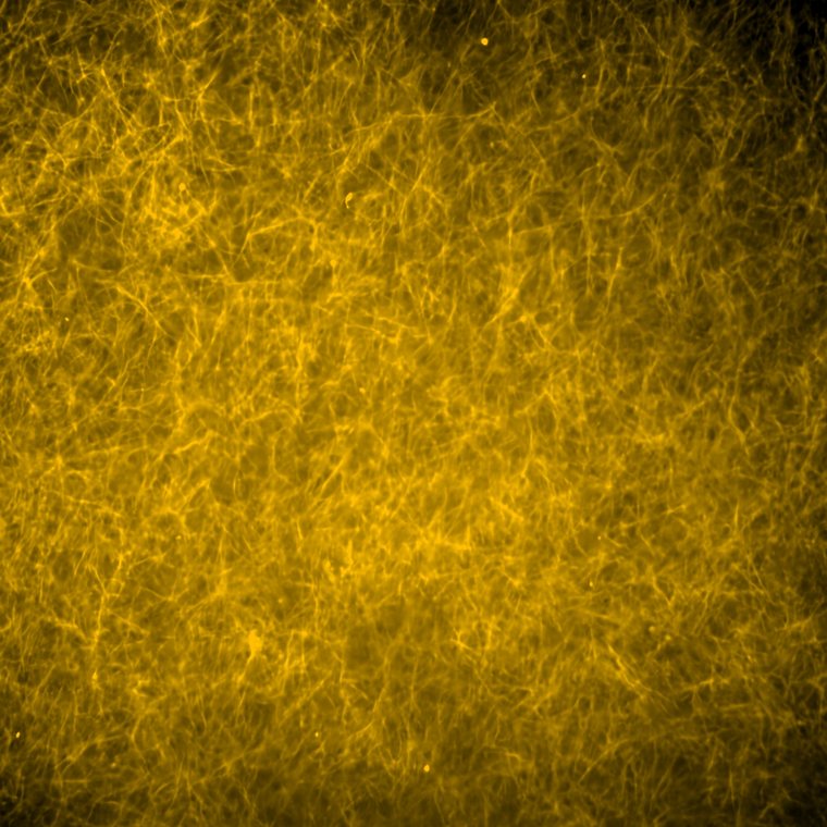 Fluorescence micrograph of a dense collagen fiber network